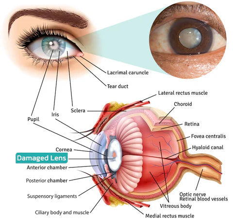 VisionClaire B
