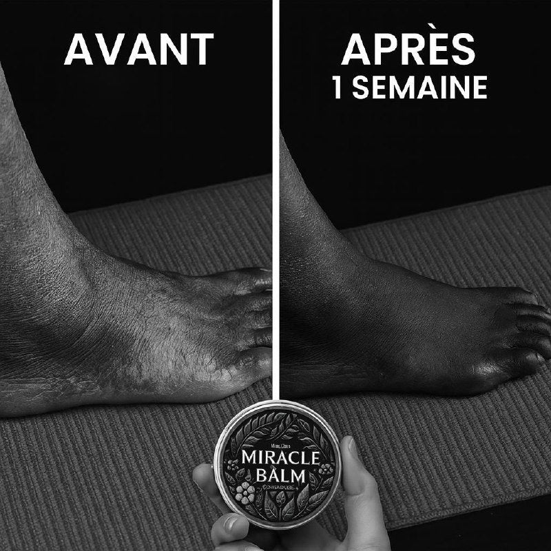 MIRACLE BALME