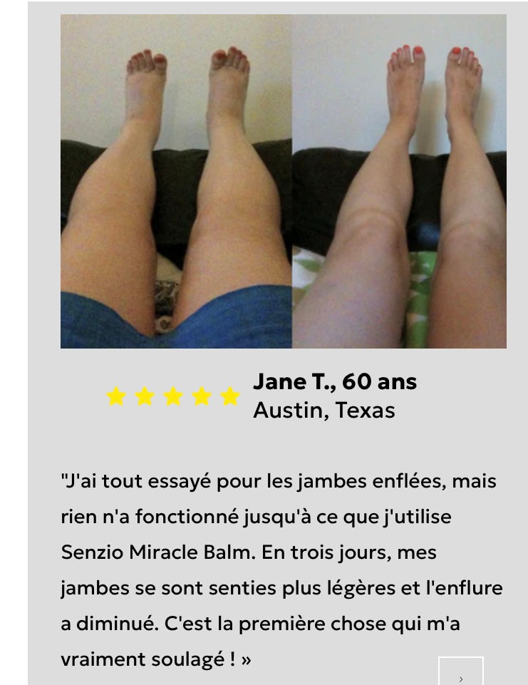 MIRACLE BALME NOUVEAU AU BENIN